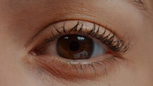 Síndrome do olho seco